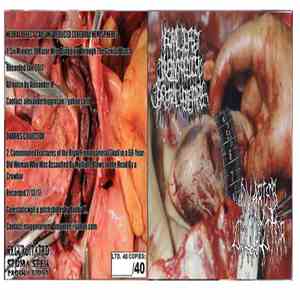 NxDxCxRxCxH / Ovaries Collector - NxDxCxRxCxH / Ovaries Collector download free
