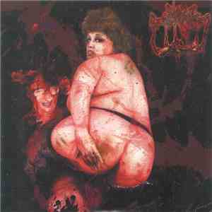Sublime Cadaveric Decomposition / Lymphatic Phlegm - Sublime Cadaveric Decomposition / Serum Sickness Syndrome download free