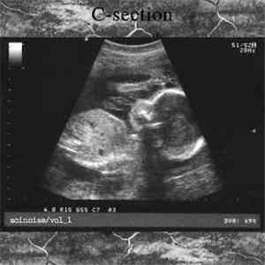 Various - C-Section download free